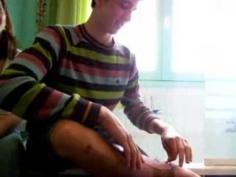 Epilation Lucas
