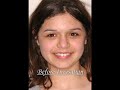 Shine--Invisalign Before & After--Mick Family Dental Care