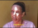 Michael Persky, MD - Fraxel re:pair with Marta Waller 1 Michael Persky, MD - Fraxel re:pair with Marta Waller 1