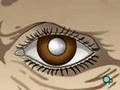 PreOp® Patient Education Cataract Small Incision Eye