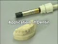 Anterior Jacket Crown Part 1