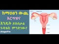 ከማህፀን ውጪ እርግዝና እንዴት ይከሰታል ጉዳቱስ ምንድነው