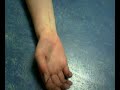 My arm!