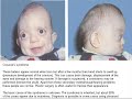 my-beat-the-rebirth.html