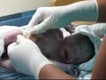 Joaquin Kaled Alva Cruz Parto Cesarea Joaquin Kaled Alva Cruz Parto Cesarea