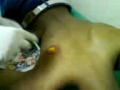 BIG HOLE