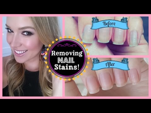 how to whiten stained nails