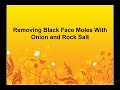 Removing Skin Moles Using Onion and Rock Salt