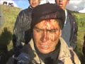 Herido en la cabeza 150k Herido en la cabeza 150k