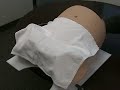 Vacuum Assisted Delivery: A Brief Summary of Key Principles Vacuum Assisted Delivery: A Brief Summary of Key Principles