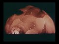 Hydrogen Bomb: Nuclear Explosion Operation Ivy