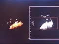 echographie 12 SA