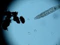 rotifer Didymodactylos carnosus