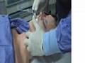 Airway -Needle cricothyrotomy on resus.com.au
