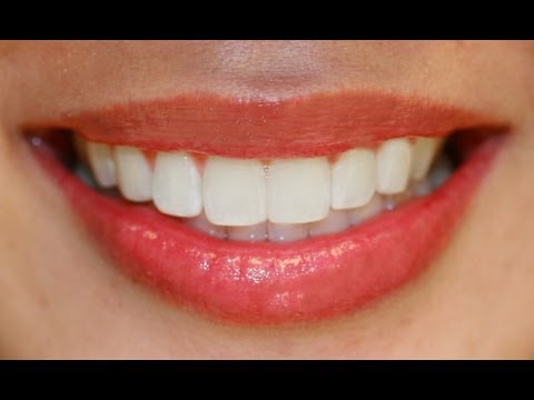 how to whiten sensitive teeth naturally