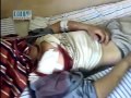 شام - حماه - صوران - طفل مصاب 15 عاما 31-7