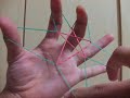 Rubber Band turns to STAR.