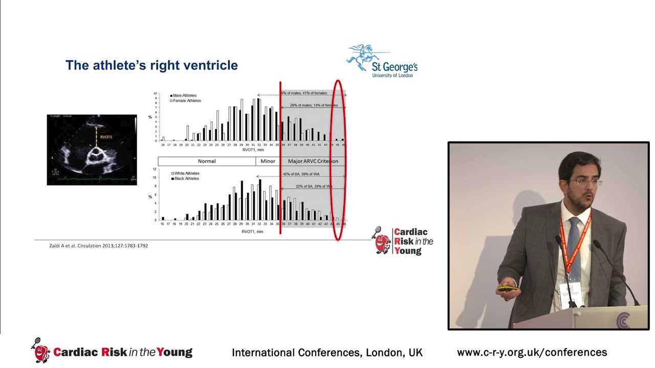 Right Ventricular Remodelling in Athletes: When Enough is Enough! - Dr Michael Papadakis