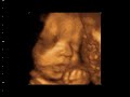 Baby Davis Smiling