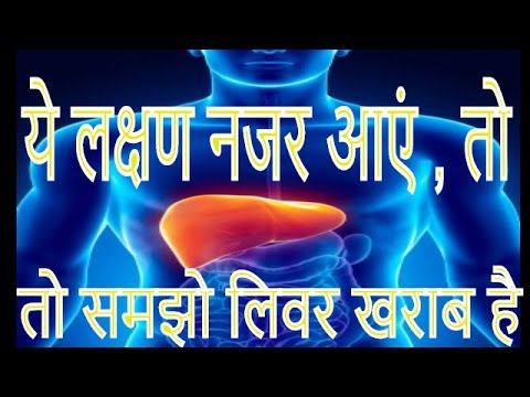 ये लक्षण नजर आएं , तो समझो लिवर खराब है || is a fatty liver painful || liver detox || liver health