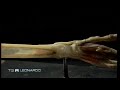 I ricercatori Bernardi e Bonaldo, dell'Università di Padova, sperimentano l'utilizzo della ciclosporina per curare la distrofia congenita di Ullrich. Per saperne di più http://www.telethon.it