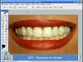 MaSsaTV || Tutorial Photoshop [ Blanquear dientes ]