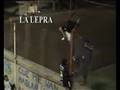 La lepra