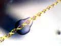 DNA, RNA og Pr�t�n