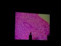 Uterus Proliferative Stage Histology