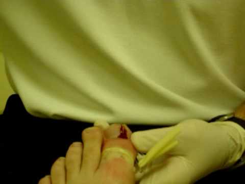 toenail