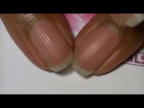 how to get rid ridges on fingernails
