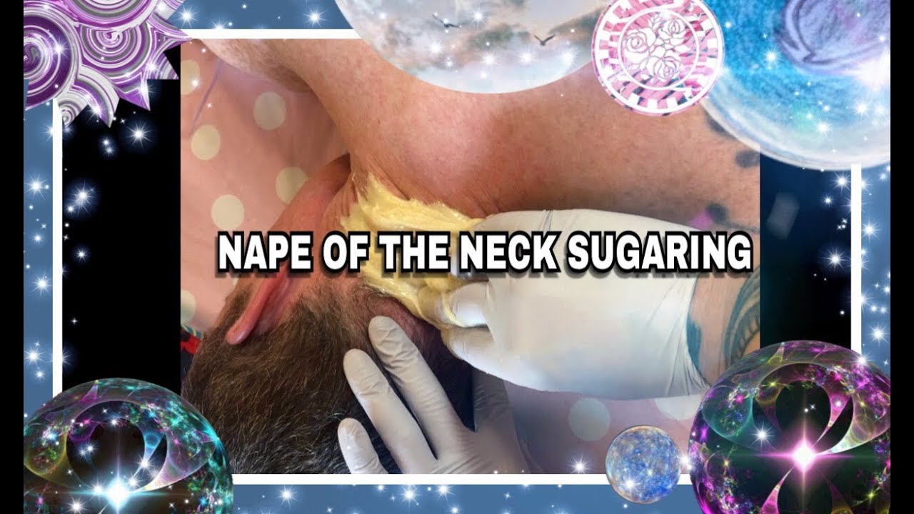 SUGARING THE NAPE OF THE NECK