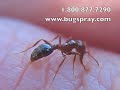 Fireant stinging closeup video Fireant stinging closeup video