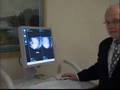 Giotto digital mammography system