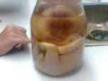 videos de FETO