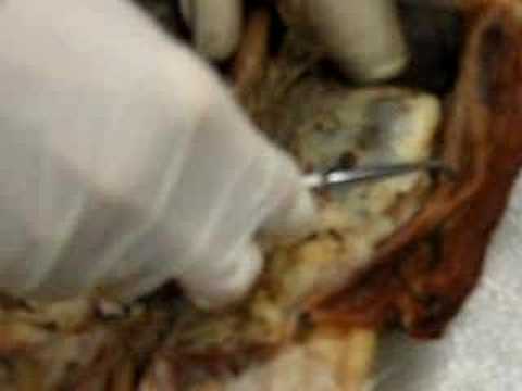 Cat fatty layer parietal peritoneum