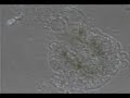 Death of an Amoeba