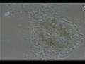 videos de Death of an Amoeba