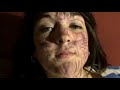drunk girls discover the meanings of moles