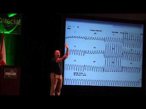 how to treat non sustained v tach