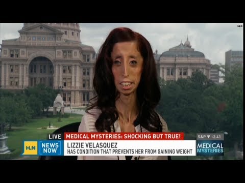 Strange & bizarre medical mysteries | Dr. Donald Ryles Paranormal