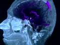 The Brain Fitness Program PBS 4x3 NEW Trailer