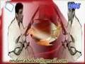 ��TE ARABESK ��TE HAKKI BULUT  NEYE YARAD I 