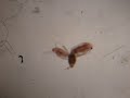 Hydra feeding