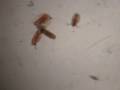 Hydra feeding - YouTube