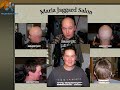 Michael Chemotherapy Patient Hair System Delivery Michael Chemotherapy Patient Hair System Delivery