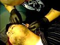 ear stretching