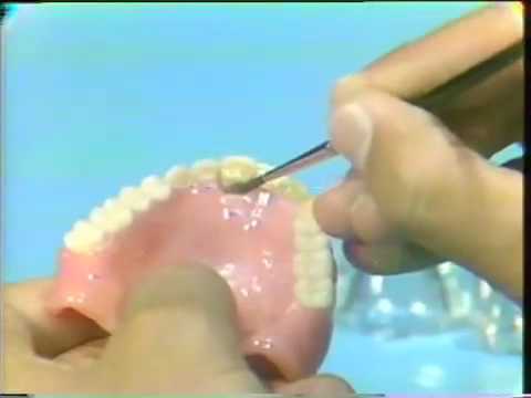 how to repair broken dentures