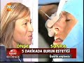 Op. Dr.Tunç TİRYAKİ  Burun Asma Operasyonu