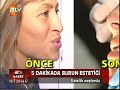 Op. Dr.Tunç TİRYAKİ  Burun Asma Operasyonu